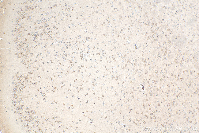 FBXO44 Antibody in Immunohistochemistry (Paraffin) (IHC (P))