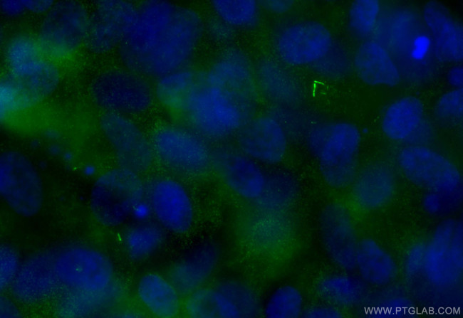 CEP89, CCDC123 Antibody in Immunocytochemistry (ICC/IF)