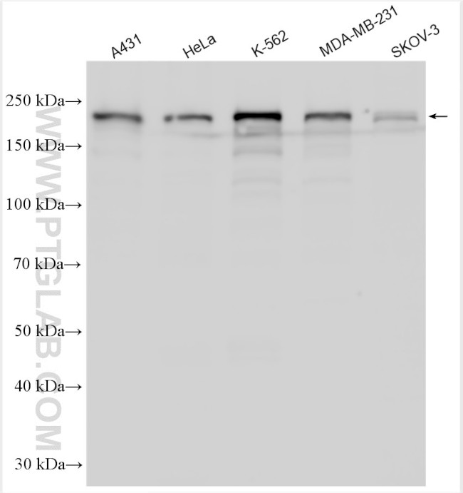 KIAA1429 Antibody in Western Blot (WB)