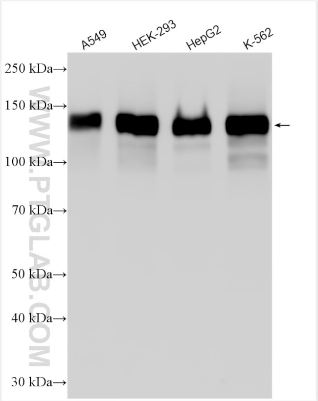 LATS1 Antibody in Western Blot (WB)