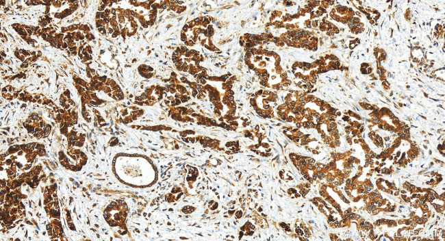 LASS2 Antibody in Immunohistochemistry (Paraffin) (IHC (P))