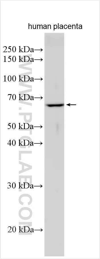 MEX3B Antibody in Western Blot (WB)