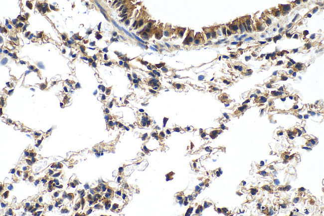 PDZD2 Antibody in Immunohistochemistry (Paraffin) (IHC (P))