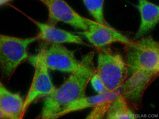 SMPD1, ASM Antibody in Immunocytochemistry (ICC/IF)