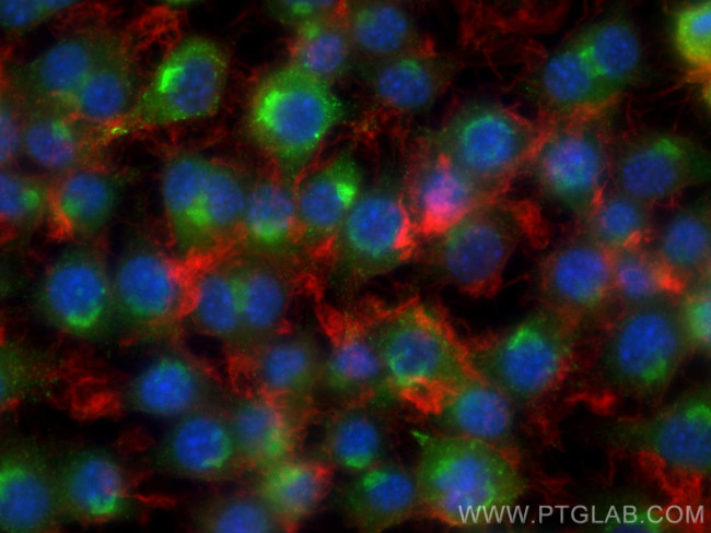 Osteopontin Antibody in Immunocytochemistry (ICC/IF)