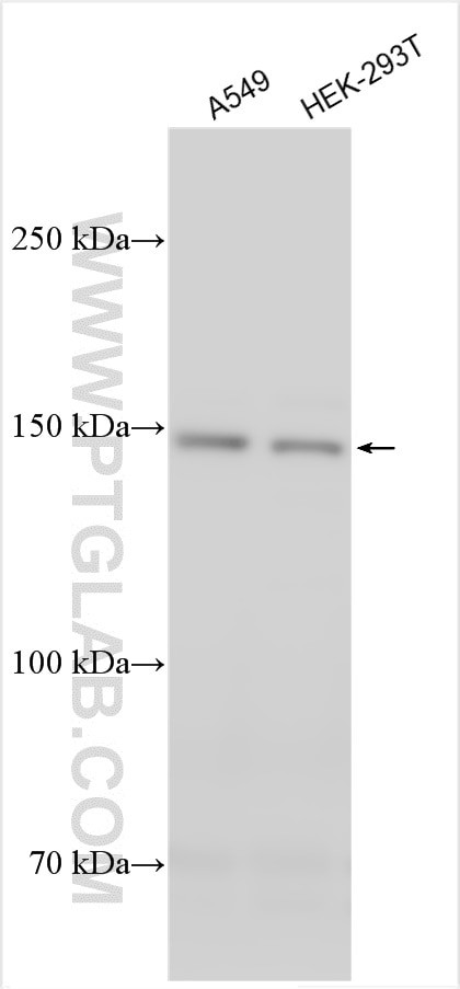 COL5A3 Antibody in Western Blot (WB)