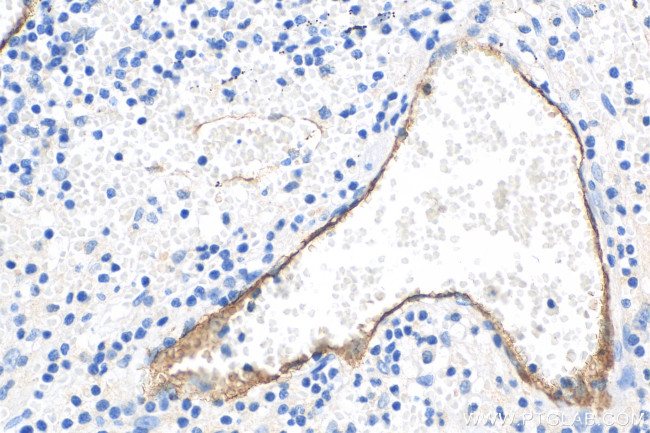 E-selectin/CD62E Antibody in Immunohistochemistry (Paraffin) (IHC (P))