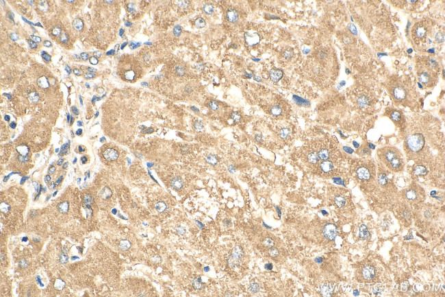 CEP162 Antibody in Immunohistochemistry (Paraffin) (IHC (P))