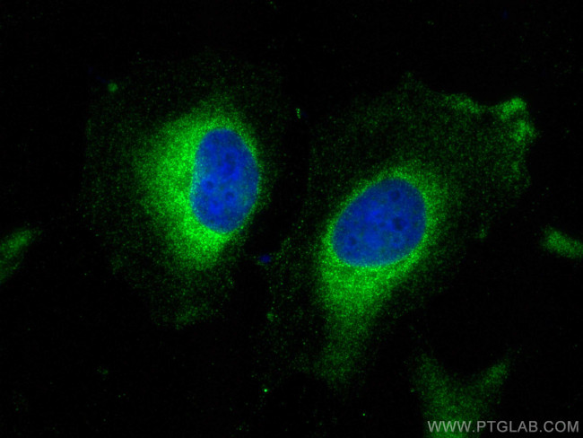 SLC7A8 Antibody in Immunocytochemistry (ICC/IF)