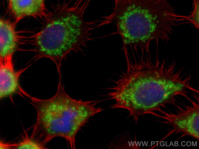 BRAWNIN Antibody in Immunocytochemistry (ICC/IF)