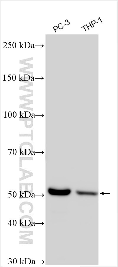 TBXAS1 Antibody in Western Blot (WB)