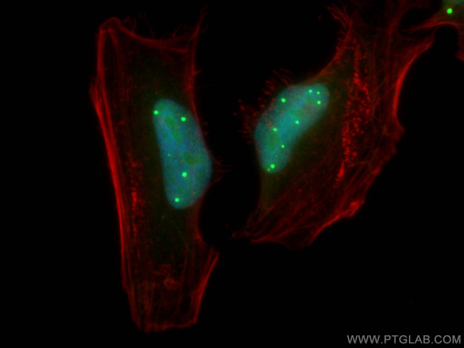TOE1 Antibody in Immunocytochemistry (ICC/IF)