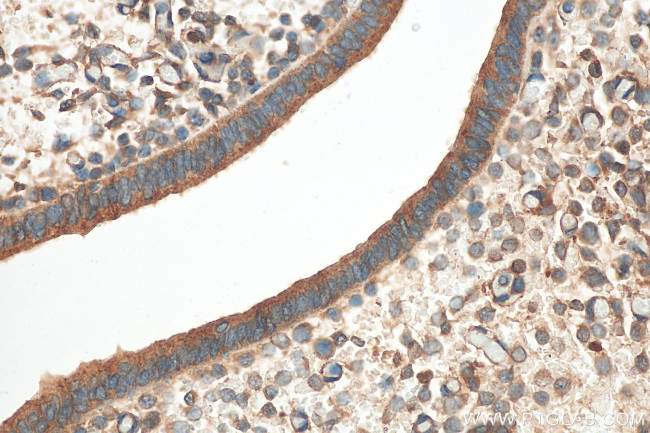 LCMT1 Antibody in Immunohistochemistry (Paraffin) (IHC (P))