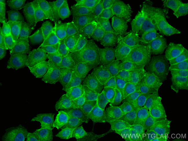 Beta-2-Microglobulin Antibody in Immunocytochemistry (ICC/IF)