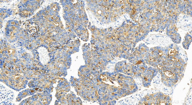 SLC7A2 Antibody in Immunohistochemistry (Paraffin) (IHC (P))