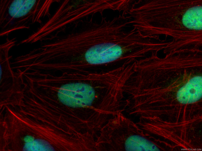 QRICH1 Antibody in Immunocytochemistry (ICC/IF)
