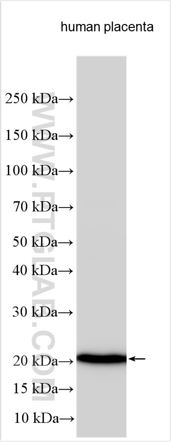 USP50 Antibody in Western Blot (WB)