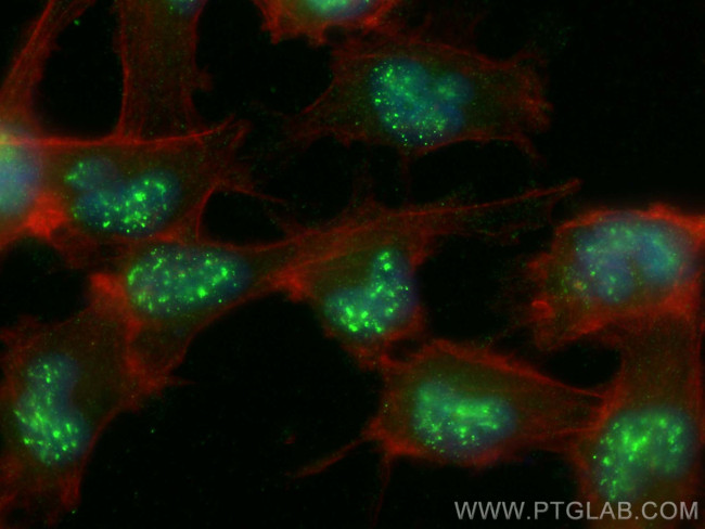 CXorf21 Antibody in Immunocytochemistry (ICC/IF)