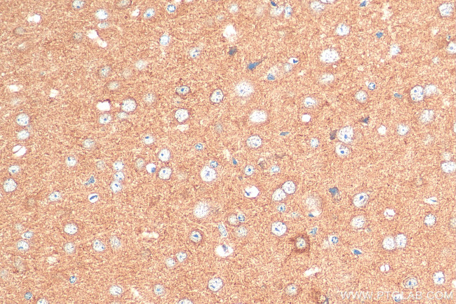 CRTAC1 Antibody in Immunohistochemistry (Paraffin) (IHC (P))