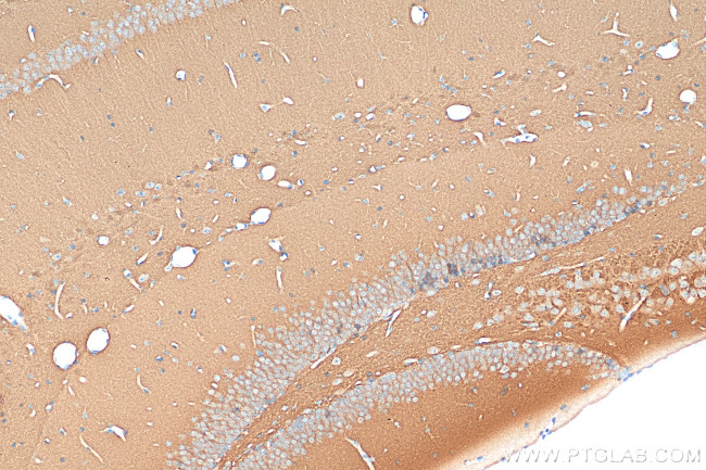 PSD95 Antibody in Immunohistochemistry (Paraffin) (IHC (P))