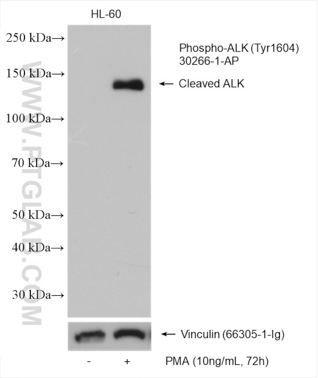 Phospho-ALK (Tyr1604) Antibody in Western Blot (WB)
