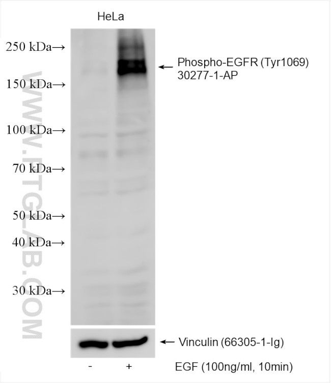 Phospho-EGFR (Tyr1069) Antibody in Western Blot (WB)