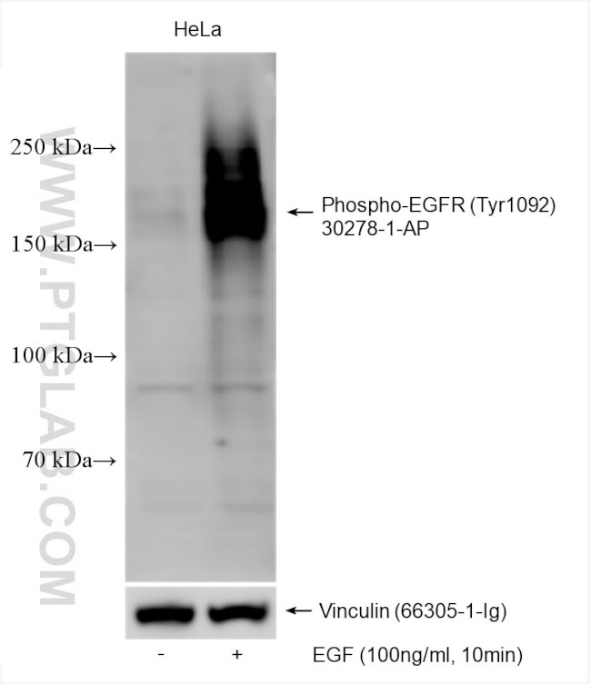 Phospho-EGFR (Tyr1092) Antibody in Western Blot (WB)