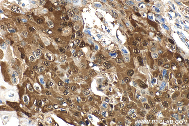 PTPN9 Antibody in Immunohistochemistry (Paraffin) (IHC (P))