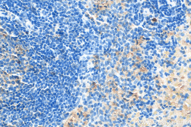 IFN Gamma Antibody in Immunohistochemistry (Paraffin) (IHC (P))