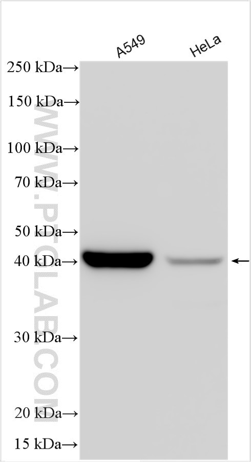 TMEM106B Antibody in Western Blot (WB)