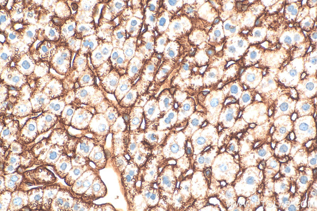 Icam-1 Antibody in Immunohistochemistry (Paraffin) (IHC (P))
