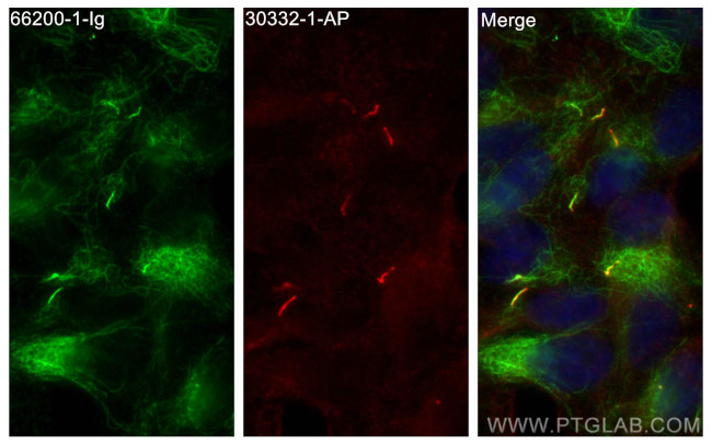ARL13B Antibody in Immunocytochemistry (ICC/IF)