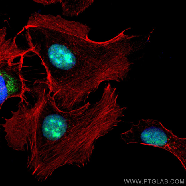 FGF-2 Antibody in Immunocytochemistry (ICC/IF)