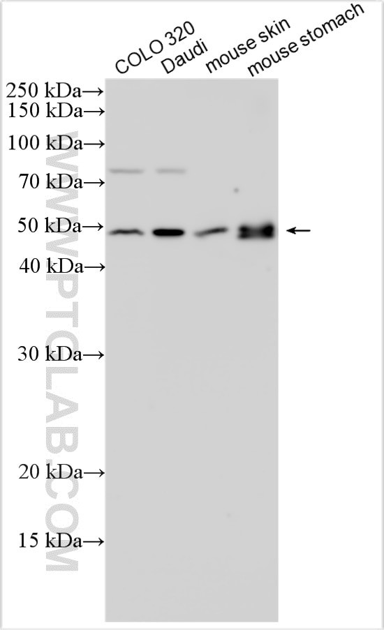 GSDMA Antibody in Western Blot (WB)