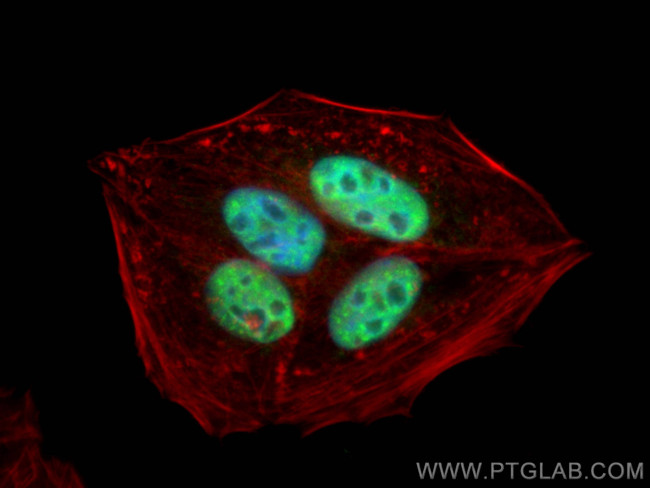RB1 Antibody in Immunocytochemistry (ICC/IF)