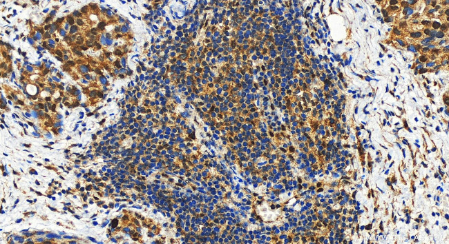 RB1 Antibody in Immunohistochemistry (Paraffin) (IHC (P))