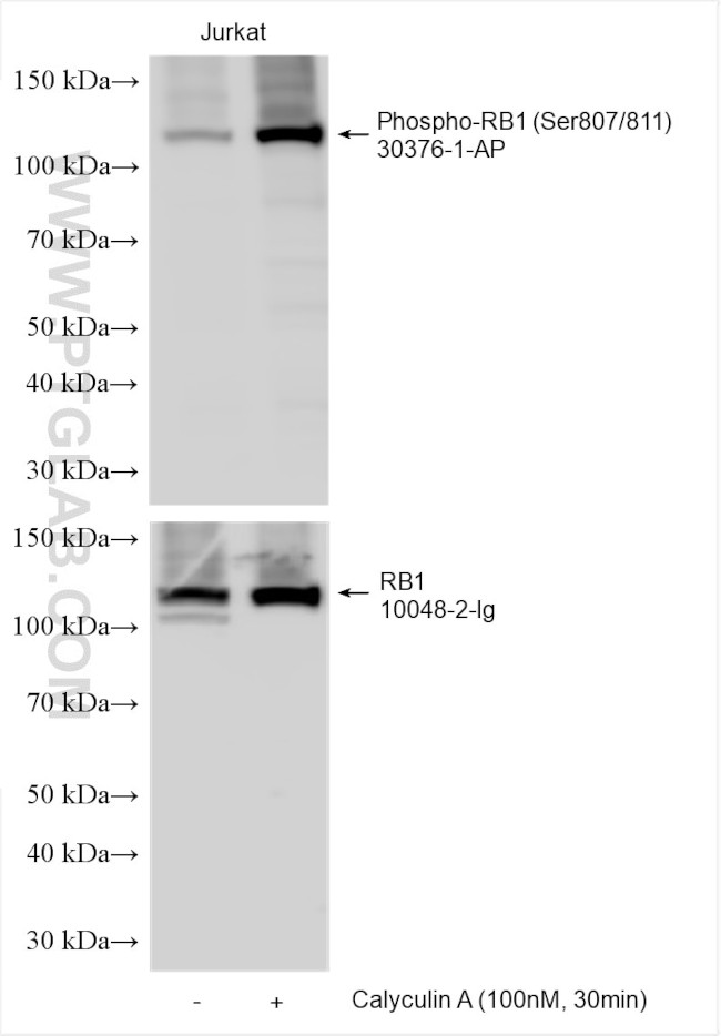 Phospho-RB1 (Ser807, Ser811) Antibody in Western Blot (WB)