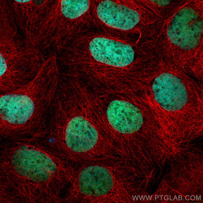CDX2 Antibody in Immunocytochemistry (ICC/IF)