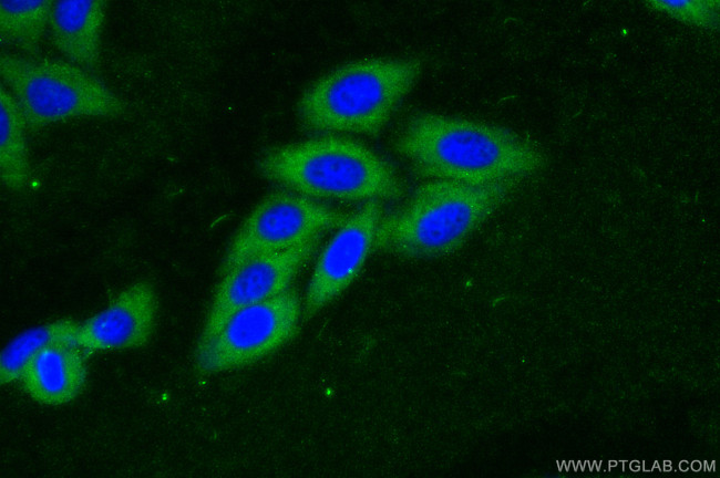p38 MAPK Antibody in Immunocytochemistry (ICC/IF)