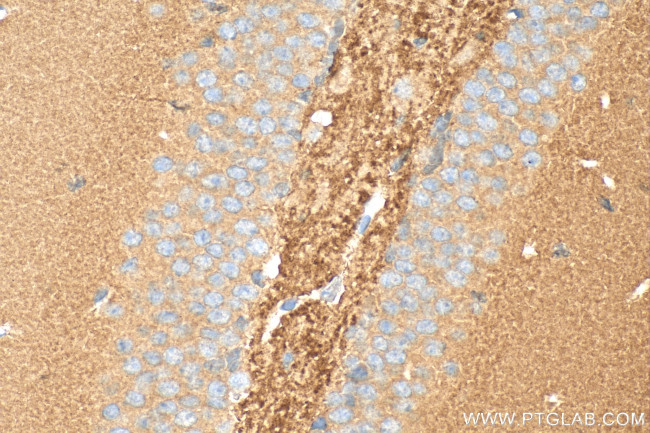 Bassoon Antibody in Immunohistochemistry (Paraffin) (IHC (P))