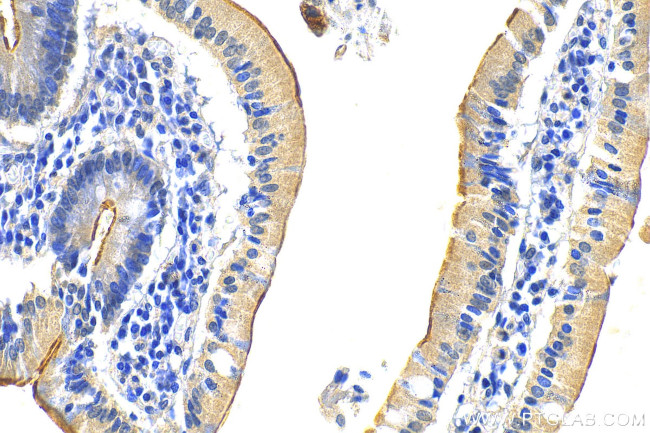 MUC5AC Antibody in Immunohistochemistry (Paraffin) (IHC (P))