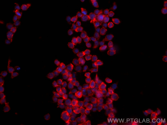CCR2 Antibody in Immunocytochemistry (ICC/IF)