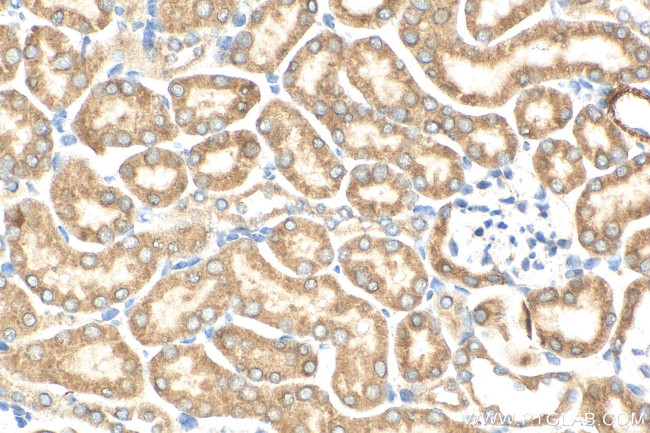 PEX3 Antibody in Immunohistochemistry (Paraffin) (IHC (P))