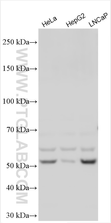 PFKFB2 Antibody in Western Blot (WB)