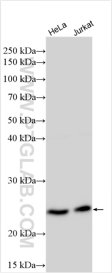 TPST2 Antibody in Western Blot (WB)