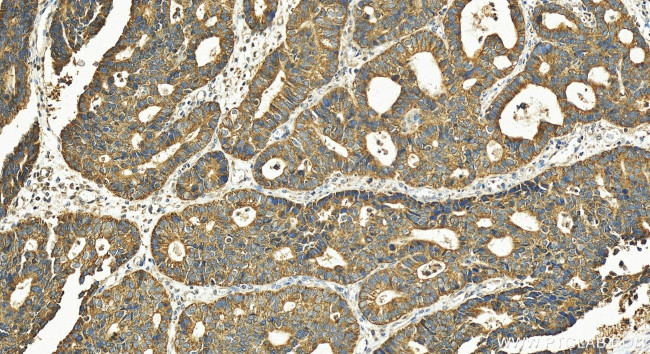 PGT Antibody in Immunohistochemistry (Paraffin) (IHC (P))