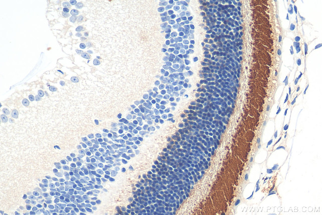 Rhodopsin Antibody in Immunohistochemistry (Paraffin) (IHC (P))