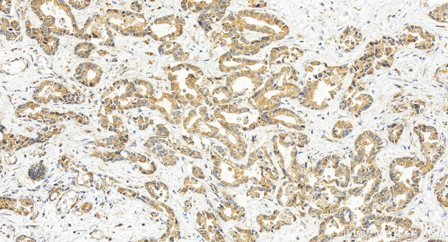USP6NL Antibody in Immunohistochemistry (Paraffin) (IHC (P))