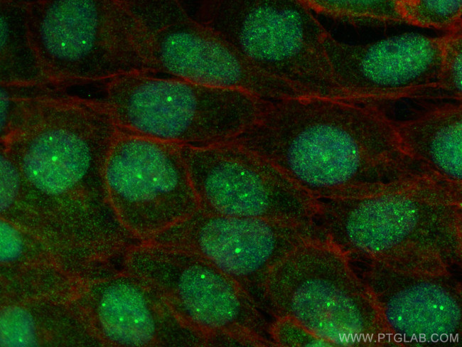 SYNCRIP Antibody in Immunocytochemistry (ICC/IF)