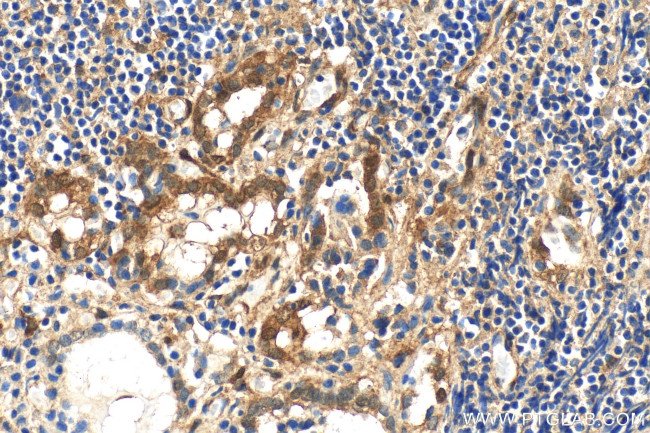 Galectin 3 Antibody in Immunohistochemistry (Paraffin) (IHC (P))